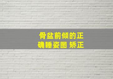 骨盆前倾的正确睡姿图 矫正